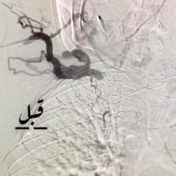 أمانة العاصمة المقدسة تصادر 800 كجم خضروات و فواكه في نطاق بلدية المعابدة